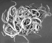 Do You Have Parasites?